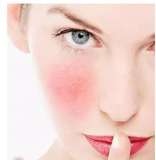 拿什么拯救你，紅血絲小姐