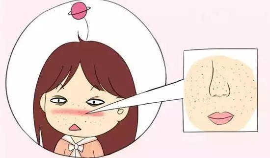 女生毛孔粗大到底應(yīng)該怎么辦？